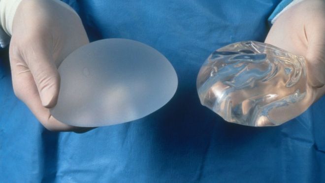 How Types Of Breast Implants: A Quick Primer can Save You Time, Stress, and Money. thumbnail